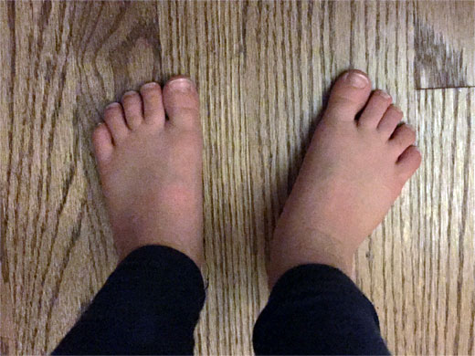 photo of 2 feet